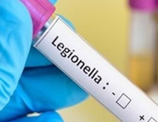 Milano, emergenza legionella: muore 89enne, è la quarta vittima