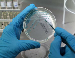 Bolzano, un nuovo caso di legionella a Don Bosco